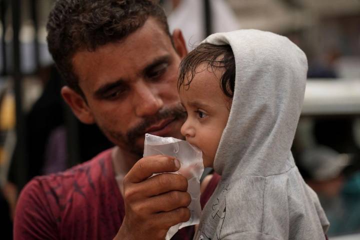 Israel asegura que no hay «desnutrición generalizada» en Gaza