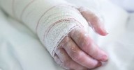 Este es el parte médico de la pareja quemada en aparente ataque de celos en Gamarra, Cesar