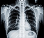 New Radiologic Technology Lab being unveiled Tuesday at YSU