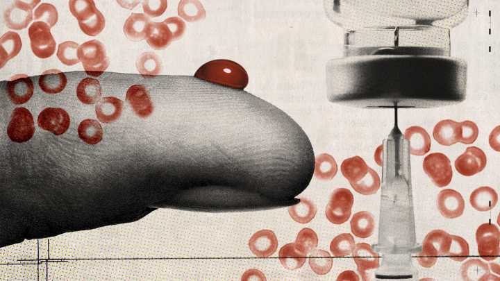 A new diabetes subtype is discovered