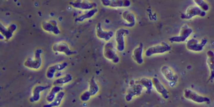 Missouri health leaders confirm death of patient with rare brain