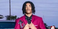 Teen explosion victim has burns on 85% of body