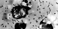 Person tests positive for the plague after being bitten by infected flea, health officials say