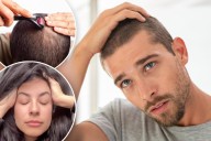 5 ways to reduce hair loss without drugs or supplements