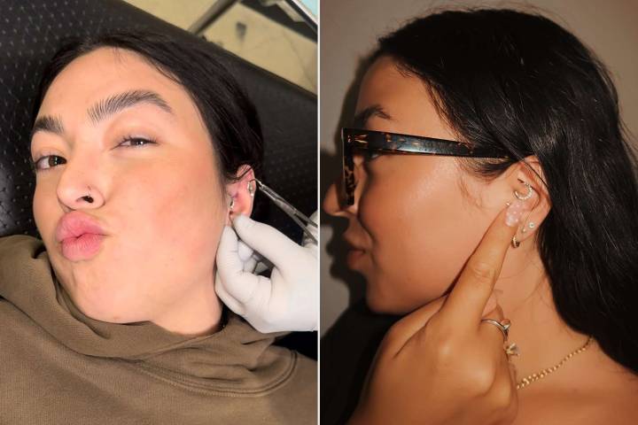 Woman Experienced Excruciating Daily Migraines Until She Got 1 Piercing (Exclusive)