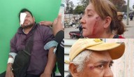 Norte salteño | Trabajador municipal perdió un ojo en represión policial tras cuatro días de paro