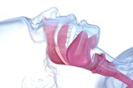 Blowing Conch Shell Tied to Improved Obstructive Sleep Apnea Measures