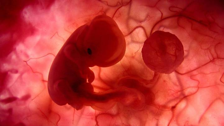 Neurociencias confirma retraso cognitivo en niños expuestos al covid en el embarazo