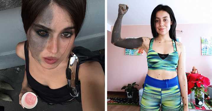 67 People Share Their Amazing And Interesting Birth Marks