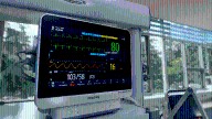 Doctors may need to rethink decades of routine beta blocker use for some patients after a heart attack, studies suggest