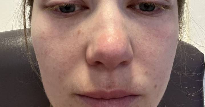 Mum had to save woman's life after she thought puffy face was hay fever