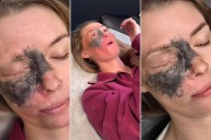 Woman Gets Eyebrow Tattoo After Cancer Treatment (Exclusive)