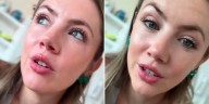 Stephanie Demner contó la delicada situación de salud que vivió por sus trastornos alimenticios