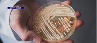 Infections involving 'superbug' fungus persisting in Nevada, data shows