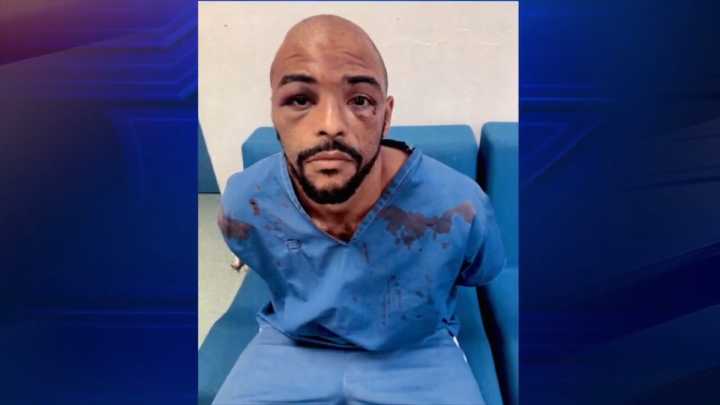 Family of inmate allegedly beaten by multiple corrections officer in Miami