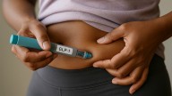 GLP-1 Receptor Agonists Improve HS in Patients With Obesity