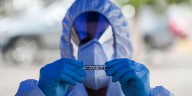 Detectan caso de peste en California: ¿Cuáles son los síntomas y qué tan peligrosa es?