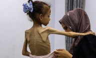 El mundo se rindió: la ONU confirmó la hambruna forzada por Israel y todo sigue igual