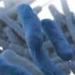 New Yorkers who get Legionnaires’ disease have legal rights. Here’s what you should know.