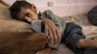 La desnutrición infantil se triplica desde marzo en la Franja de Gaza, según la ONU