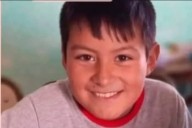 Niño que sufrió graves quemaduras continúa con cirugías e injertos en el hospital Garrahan