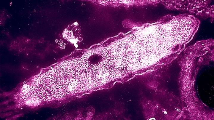 NYC Legionnaires’ disease cluster grows to 99 cases, 4 deaths