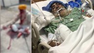 Sikh community rallies after Harpal Singh brutally beaten with golf club in North Hollywood attack