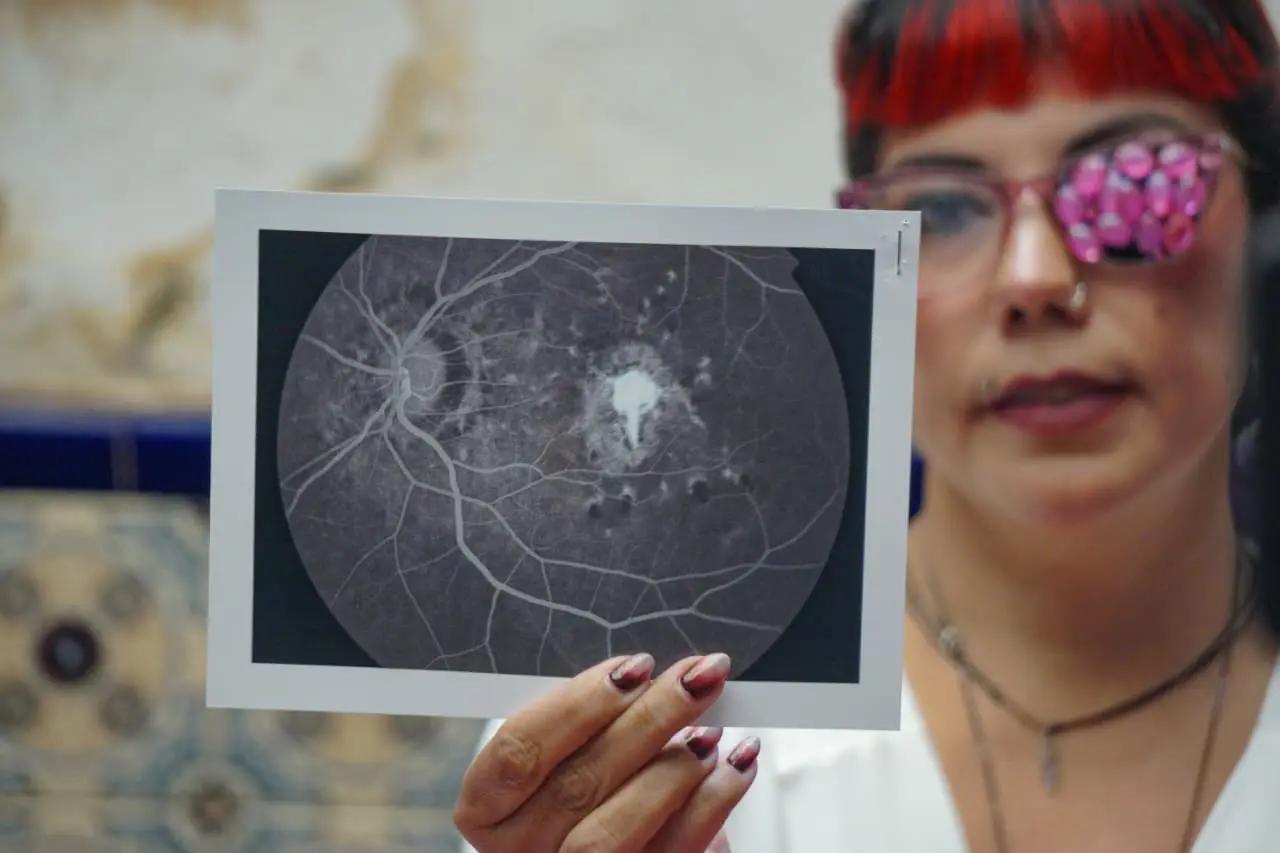 Falta de protección expone a trabajadora del IMSS a enfermedad ocular