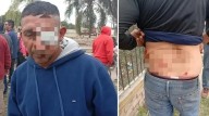 Conflicto municipal en Hipólito Yrigoyen: Un empleado perdió un ojo y hay otros heridos