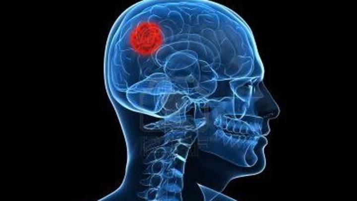 Detectan un cáncer después de que el paciente empezara a oler algodón de azúcar de forma aleatoria