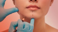 Buscan belleza con cirugía ideal; quieren queda como ‘Filtro de redes sociales