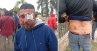 Crece la tensión en Hipólito Yrigoyen tras una brutal represión: un trabajador perdió un ojo