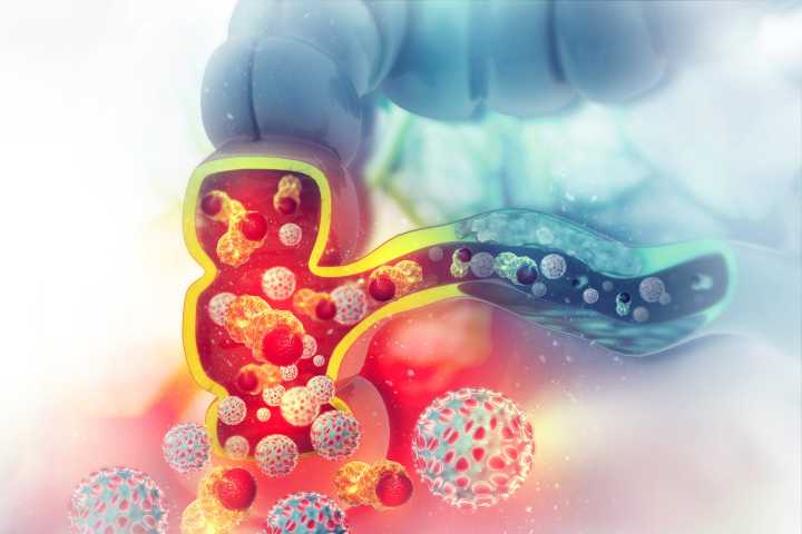 Colon Cancer Triplet Therapy Trial by Anbogen Gets FDA Nod