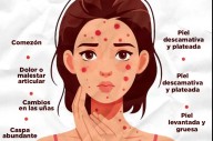 Psoriasis: un diagnóstico temprano puede cambiar la historia de quienes tienen síntomas