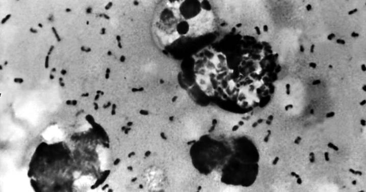 First plague case of the year confirmed in pet cat in Evergreen, Jefferson County Public Health says