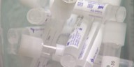 Louisiana #1 in chlamydia, #2 in gonorrhea: Baton Rouge provider on reason for high rates and how to stay on top of your health