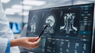 Traumatic Brain Injury Increases Risk for Future Brain Cancer