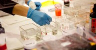 Más de 900 pacientes se benefician en Andalucía de ensayos clínicos en terapias avanzadas promovidos por la sanidad pública
