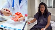 Endometriosis: la dura enfermedad que llevó a una joven colombiana a pedir la eutanasia