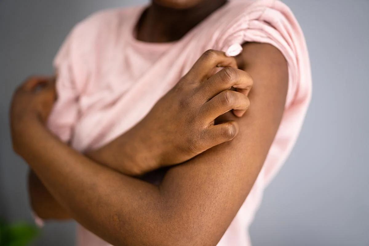 Public Believes Dermatologic Side Effects From Cancer Treatment Are Common