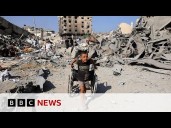 Children in Gaza 'like zombies' because of severe malnutrition, US doctor says