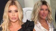 Brandi Glanville Unveils New Face After Getting to Bottom of Disfigurement