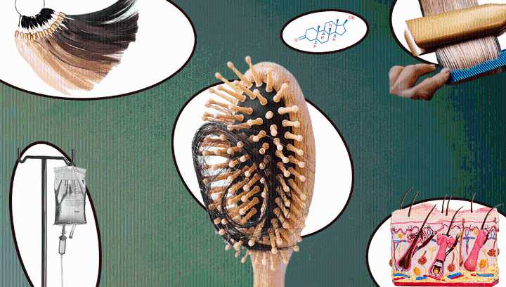 Genes, Hormones, And Hairstyling – Here Are Some Causes Of Hair Loss You Might Not Have Heard Of