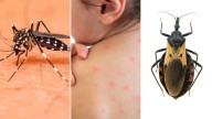 Un millón y medio de argentinos padecen el Mal de Chagas, un desafío persistente para la salud pública