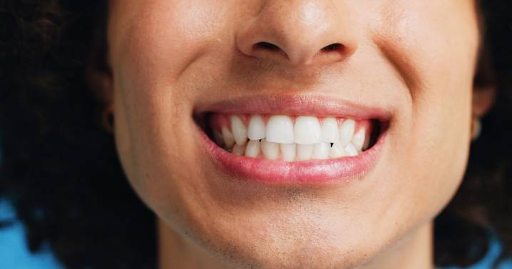 Teeth whitening strips 'left my teeth two shades whiter and brighter after 30 minutes'