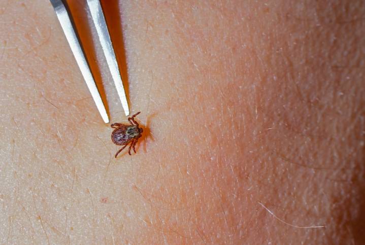 Don't ignore the bite: What you need to know about Lyme disease