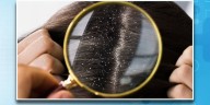 El mejor remedio casero para combatir la caspa sin dañar tu cabello