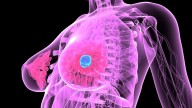Tibremciclib for Advanced Breast Cancer: Is It Worth It?