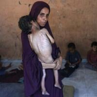 NGO says starving Gaza children too weak to cry