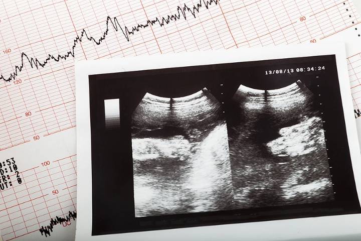 Trump administration appeals to some pro-life reproductive health care despite IVF push